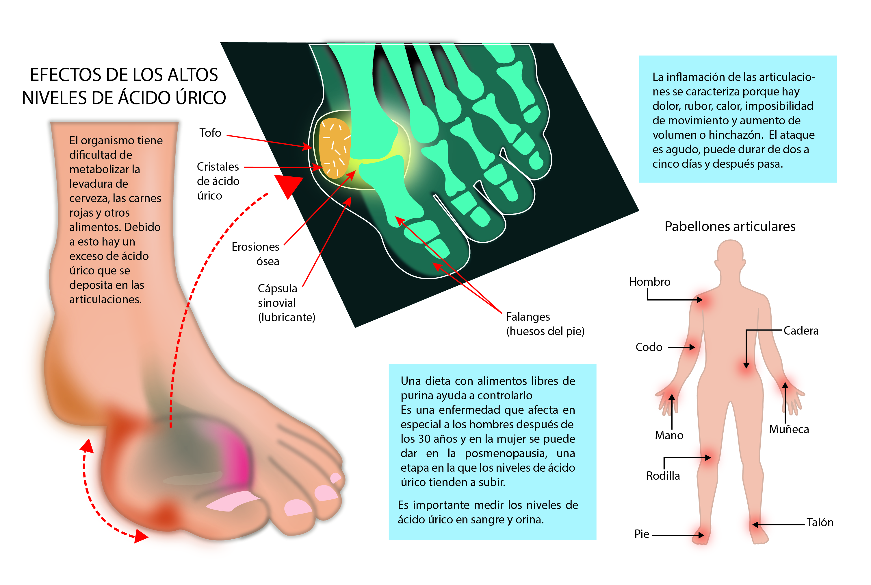 Acido folico para artritis reumatoide