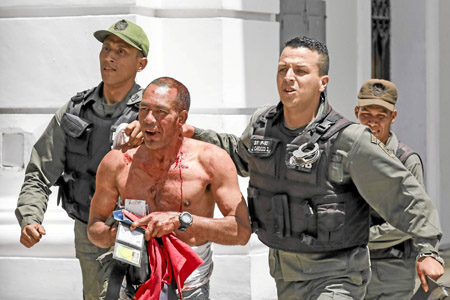 Un simpatizante del Gobierno de Nicolás Maduro, que resultó herido, es retirado de la Asamblea Nacional. 