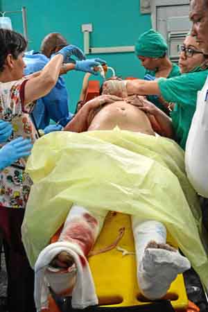 Una sobreviviente del siniestro aéreo es atendida en el hospital Calixto García de La Habana (Cuba). 