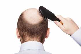 ¿Cómo evitar la caída del cabello? 