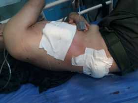 Un policía herido en hostigamiento contra comisión de la ONU, las Farc y el Gobierno 