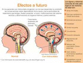 Ocho meses sin control tienen mal a Martín 
