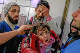 Foto | EFE | LA PATRIA   Un niño herido tras un bombardeo al este de Guta es atendido en un hospital de Duma (Siria). 