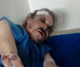 Javier Betancur, luego de la paliza que le dieron. Se recupera en el hospital de Anserma.