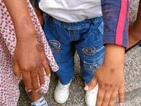 El estudio dejó entrever que las formas de violencia contra los menores se mantienen constantes.