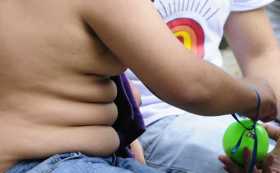 Investigadores estudian relación entre migraña y obesidad 