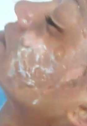 Fotos | Tomadas de video | LA PATRIA Lesiones que la agresión dejó en la mujer.