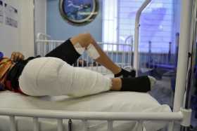 30 lesionados por pólvora ajustó Caldas 