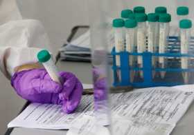 Los esfuerzos de la ciencia en tiempos de pandemia 