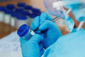 En Caldas reportan 400 nuevos contagios y 4 fallecimientos por covid-19