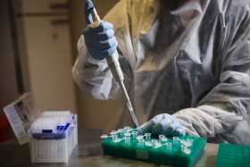 Posible vacuna contra el coronavirus desarrollada en la universidad de Oxford genera anticuerpos y es "segura"