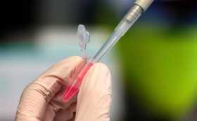 Oxford ya produce vacuna covid para venderla en diciembre