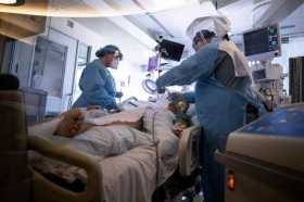 Médicos supervisan a un paciente con coronavirus en San Diego, California (EE.UU.). 