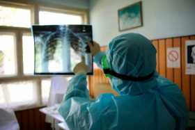 Alístese para el covid de larga duración