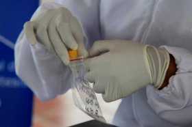 Coronavirus: 166 casos este domingo en Manizales