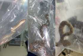 Registran caso de mordedura de serpiente en edificio Portal del Cable