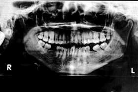 Polémica con una clínica de Manizales: paciente pide la reparación de ocho dientes