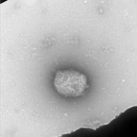  Partículas virales del virus del mono (monkeypox virus) observadas por microscopia electrónica de transmisión directamente del 