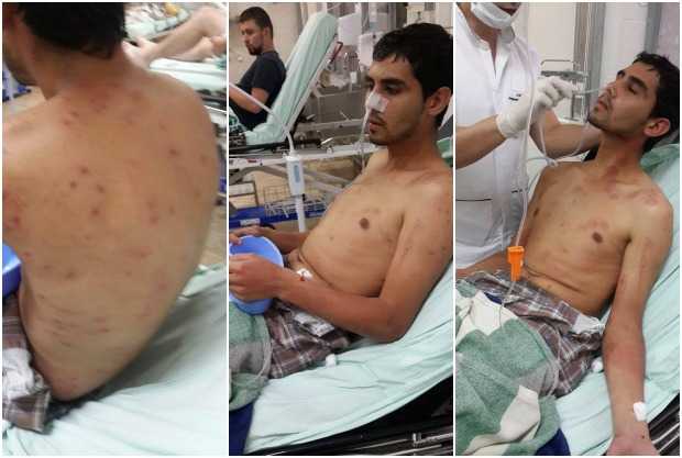 Jonathan Adrian Ocampo, estudiante de décimo semestre de Geología, está en recuperación en el Hospital Santa Sofía.