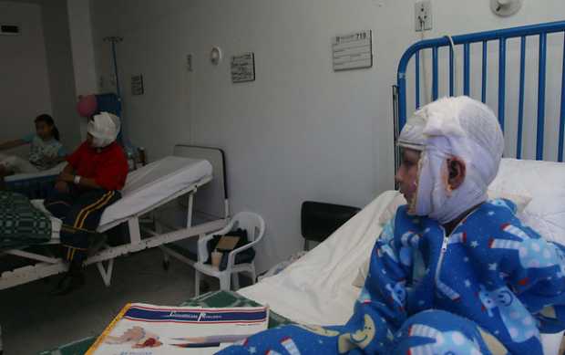 Quemados por pólvora Quemados por pólvora