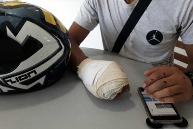 60 días de incapacidad recomendó el Instituto de Medicina Legal por las lesiones del motociclista.