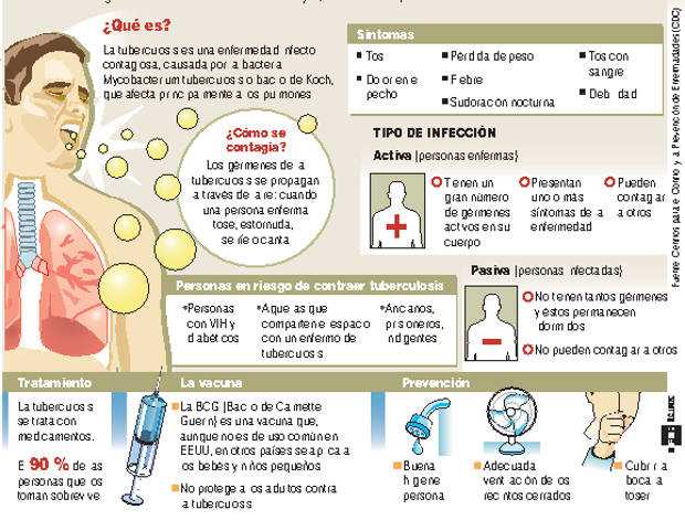 Tuberculosis