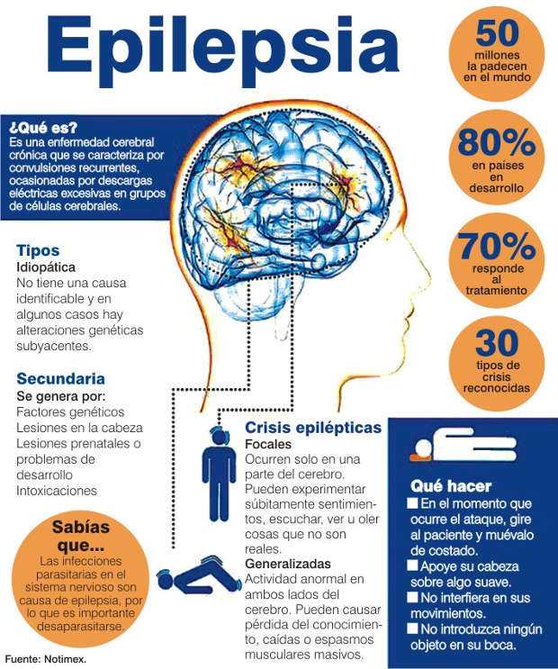 Epilepsia Epilepsia