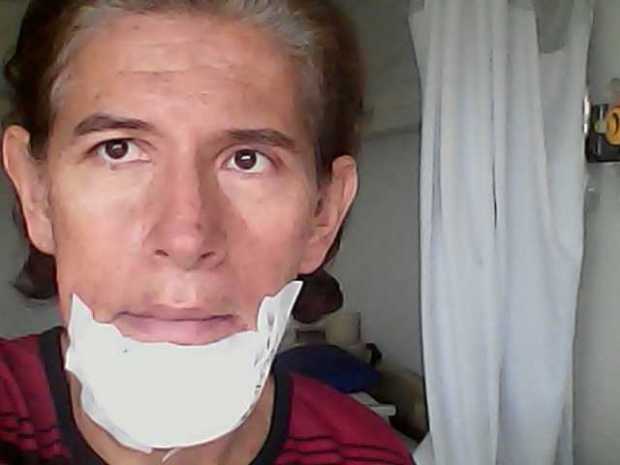 Jaime Osorio, luego de la agresión.