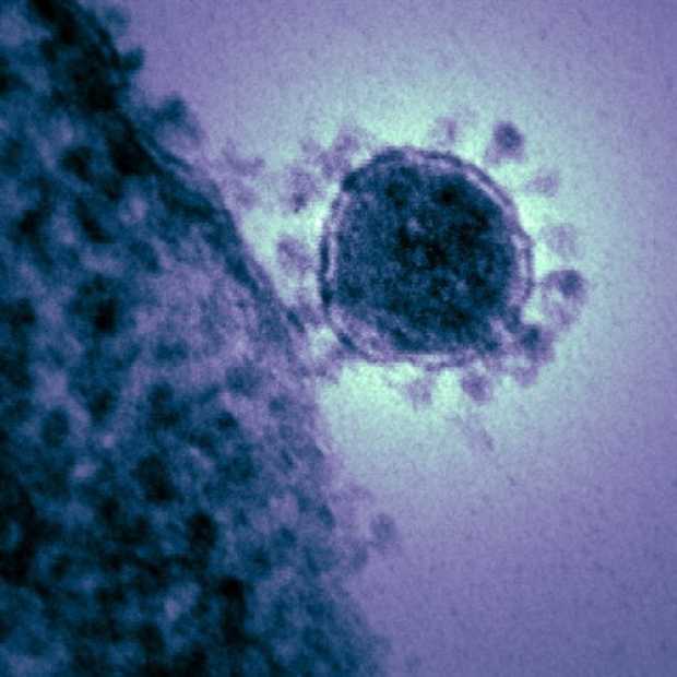 En Cali descartan caso de hombre sospechoso de portar coronavirus