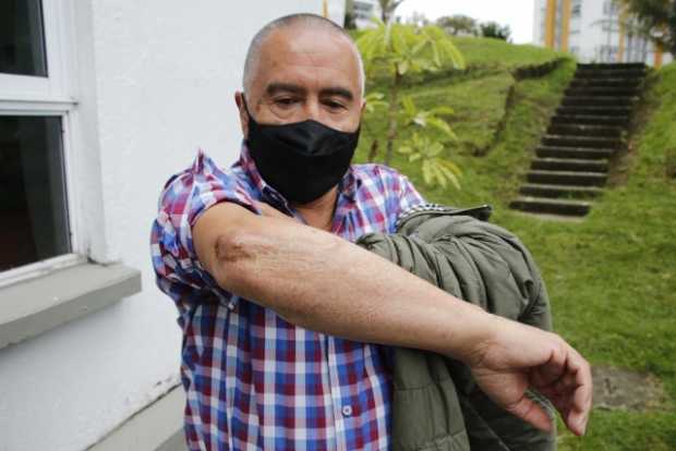 José Adolfo Murcia, herido en un ataque de la guerrilla en Arboleda, acudió a inscribirse.