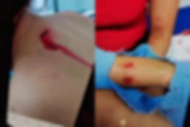La Gacela ataca con puñal a sus víctimas en Chinchiná