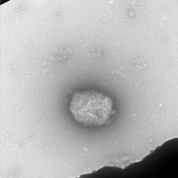  Partículas virales del virus del mono (monkeypox virus) observadas por microscopia electrónica de transmisión directamente del 