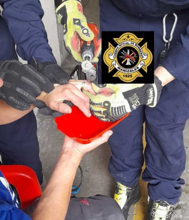 Bomberos en Manizales ayudan a quitarle anillo a un ciudadano 