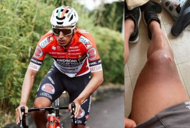 El caldense Jhónatan Restrepo se accidentó y no correrá el Giro de Italia